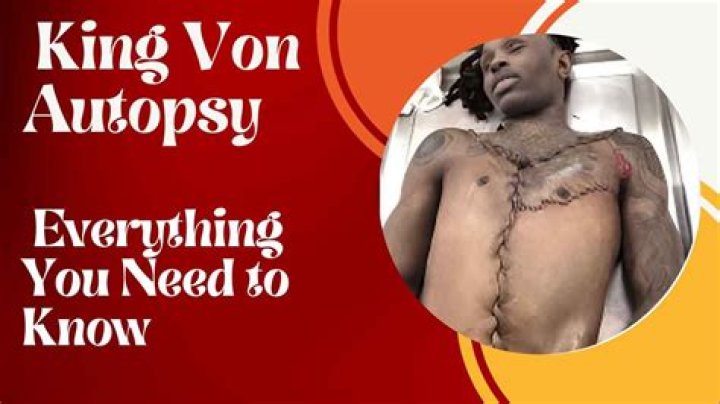 Unraveling The Mystery: King Von's Autopsy Insights