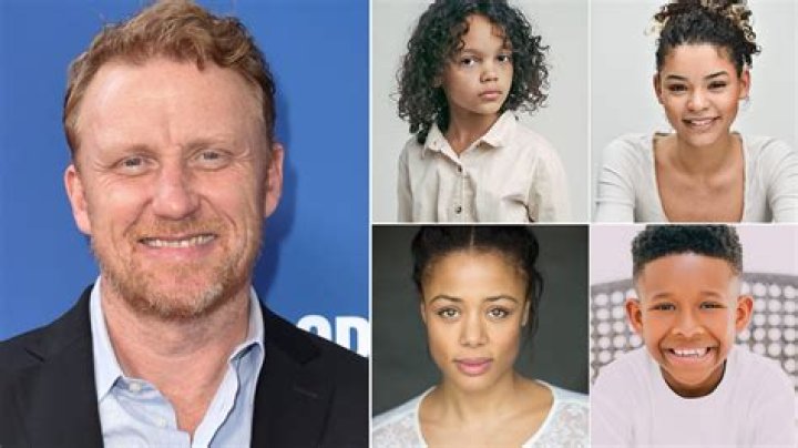 Unveiling The Talents Of Kevin McKidd: A Journey Through His Life And Career